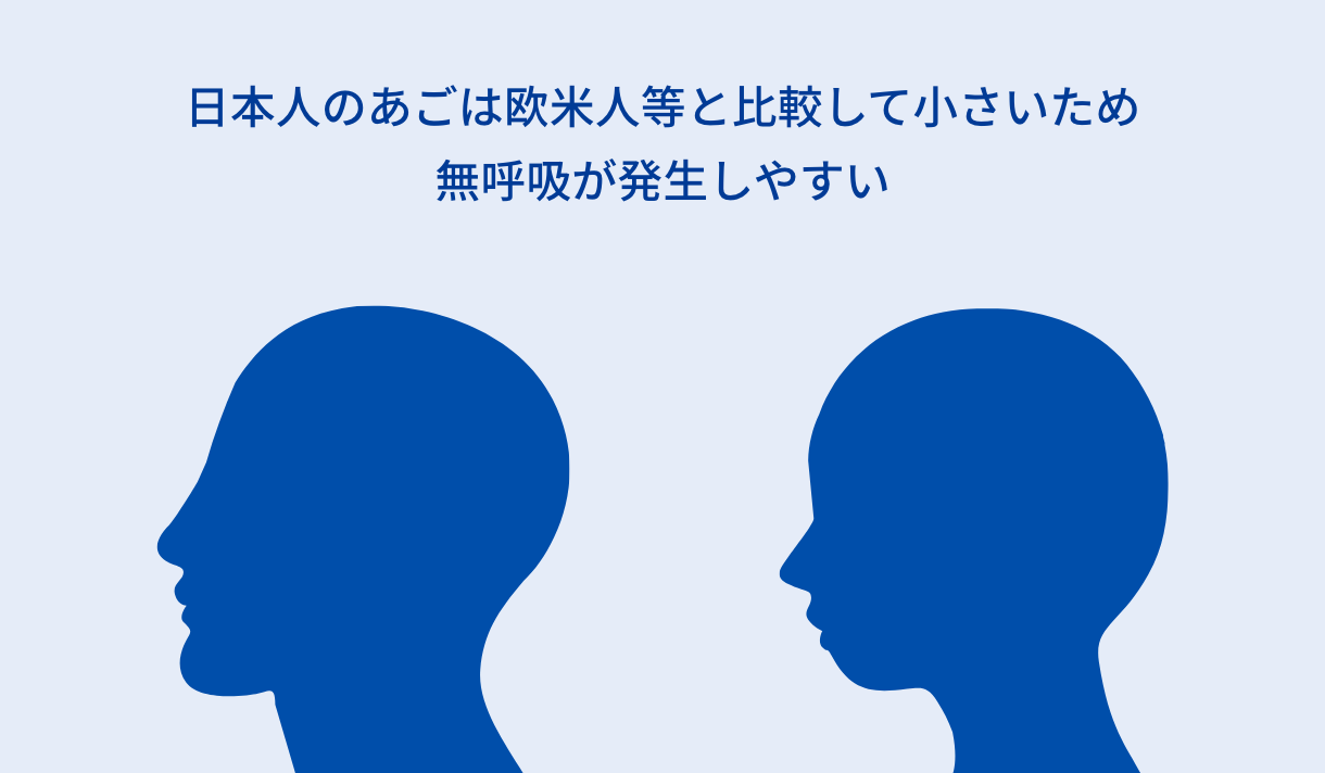 SASを放置すると突然死のリスクも高まる